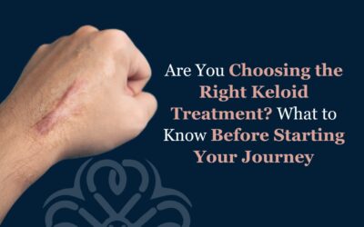 Are You Choosing the Right Keloid Treatment? What to Know Before Starting Your Journey