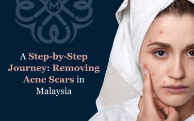 A Step-by-Step Journey: Removing Acne Scars in Malaysia