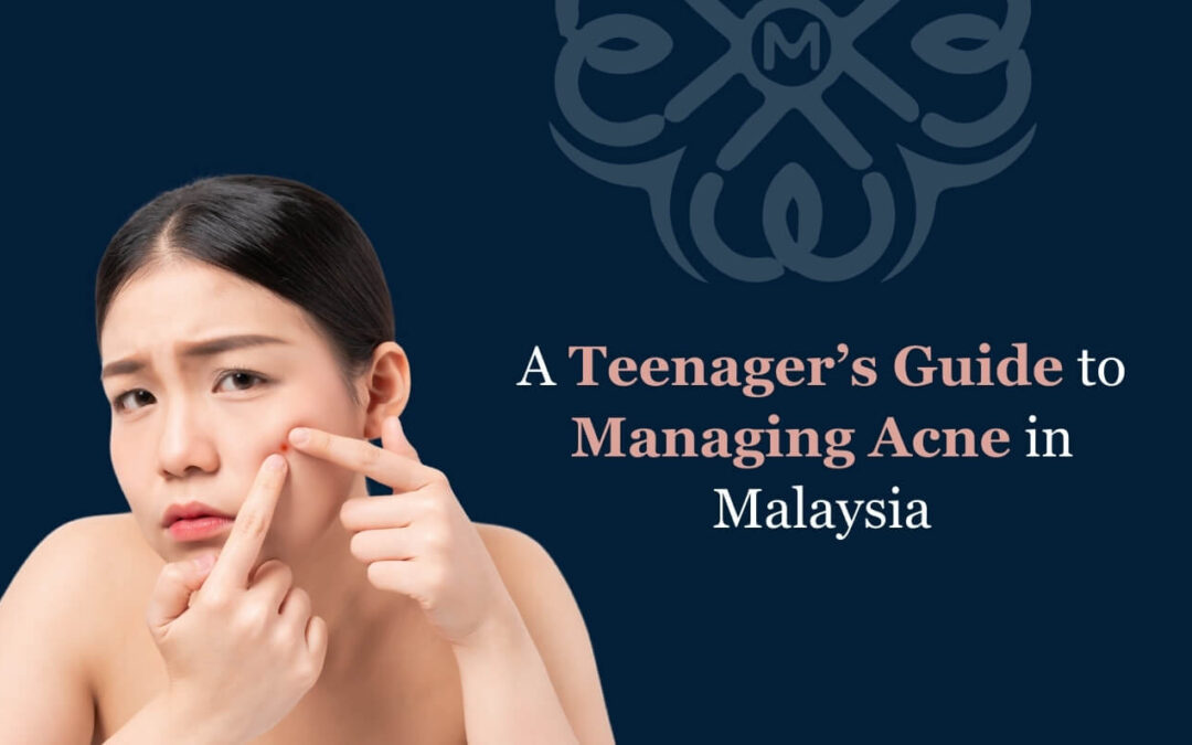 A Teenager’s Guide to Managing Acne in Malaysia