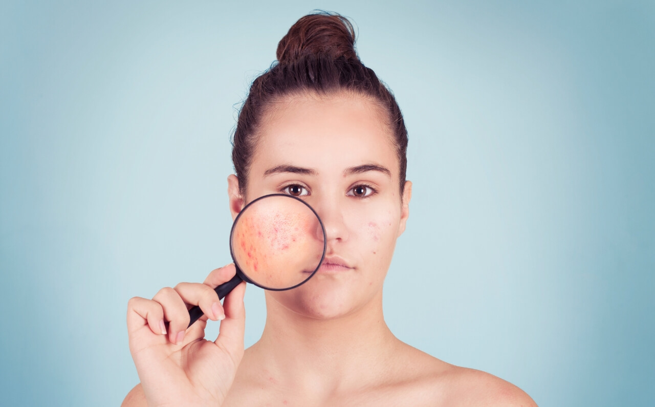A woman holding a magnifying glass to give a close up of her skin.
