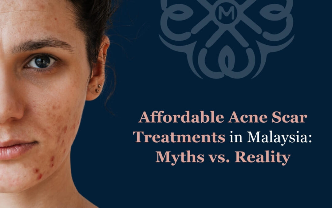Affordable Acne Scar Treatments in Malaysia: Myths vs. Reality