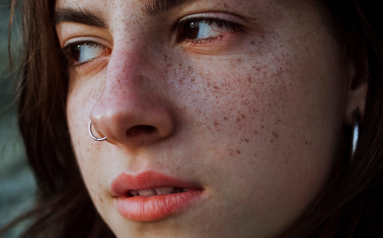 A woman with the top part of her cheeks and nose covered in freckles.