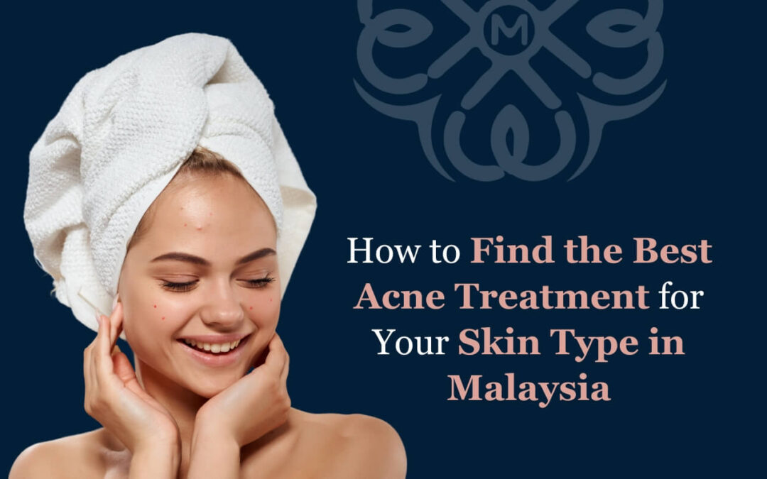 How to Find the Best Acne Treatment for Your Skin Type in Malaysia
