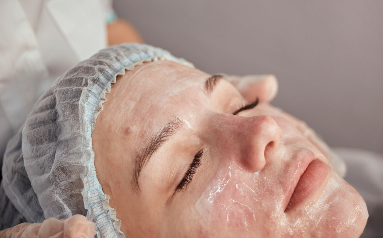 A woman undergoing a professional medical peel treatment at an aesthetic clinic.