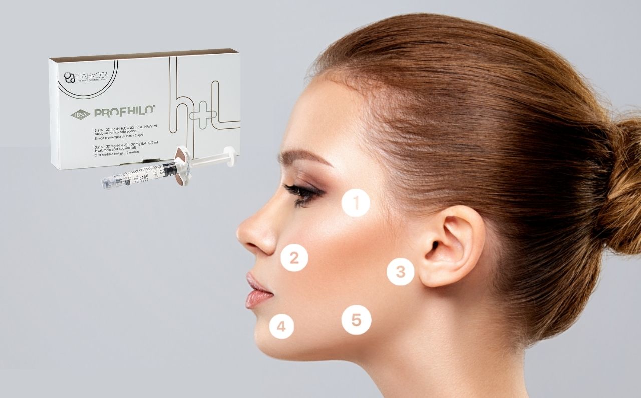 Profhilo Injection Patterns Meet Profhilo®! The Secret to Looking Fresh & Glowing All Year Around ...