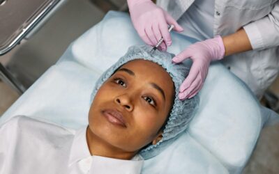 Top 10 Benefits of Profhilo for Skin Hydration and Anti-Aging
