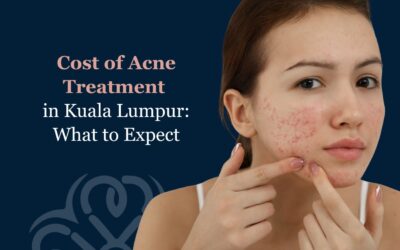 Cost of Acne Treatment in Kuala Lumpur: What to Expect