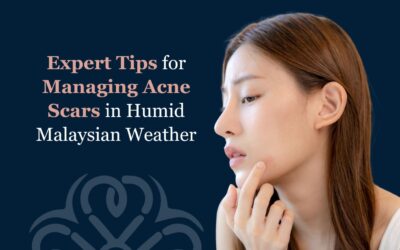 Expert Tips for Managing Acne Scars in Humid Malaysian Weather