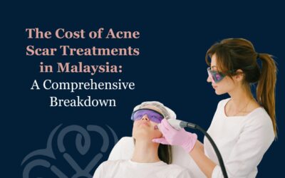 The Cost of Acne Scar Treatments in Malaysia: A Comprehensive Breakdown