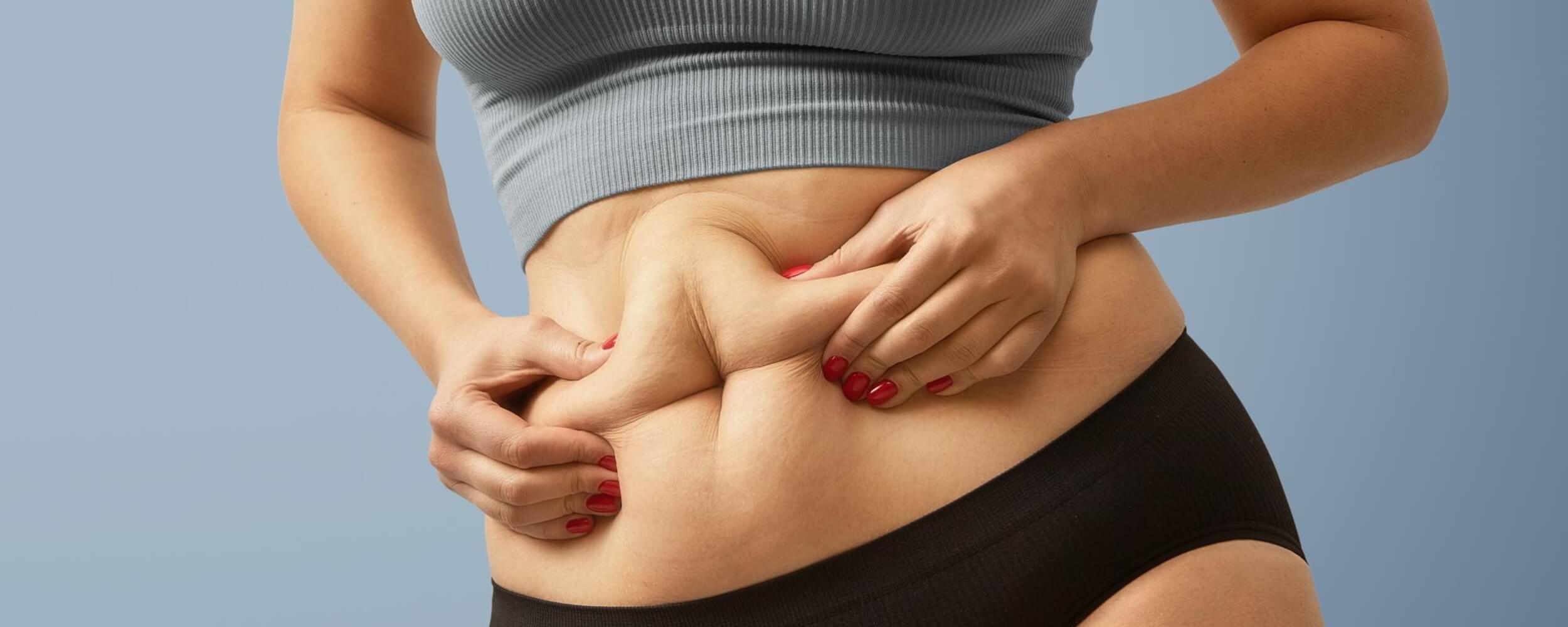 Struggling with Stubborn Fat That Resists Diet and Exercise (1)