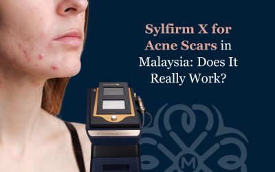 Sylfirm X for Acne Scars in Malaysia: Does It Really Work?