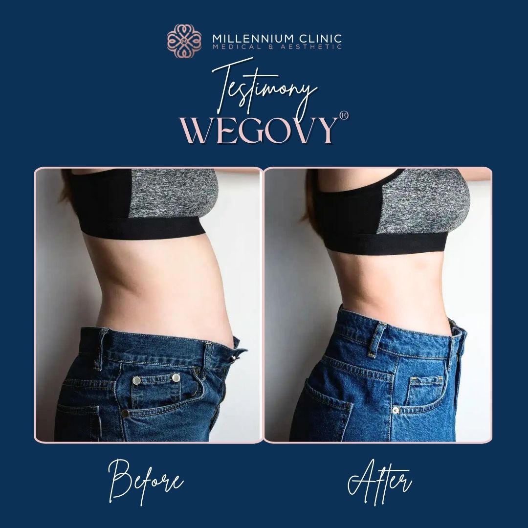 Wegovy® before after 1