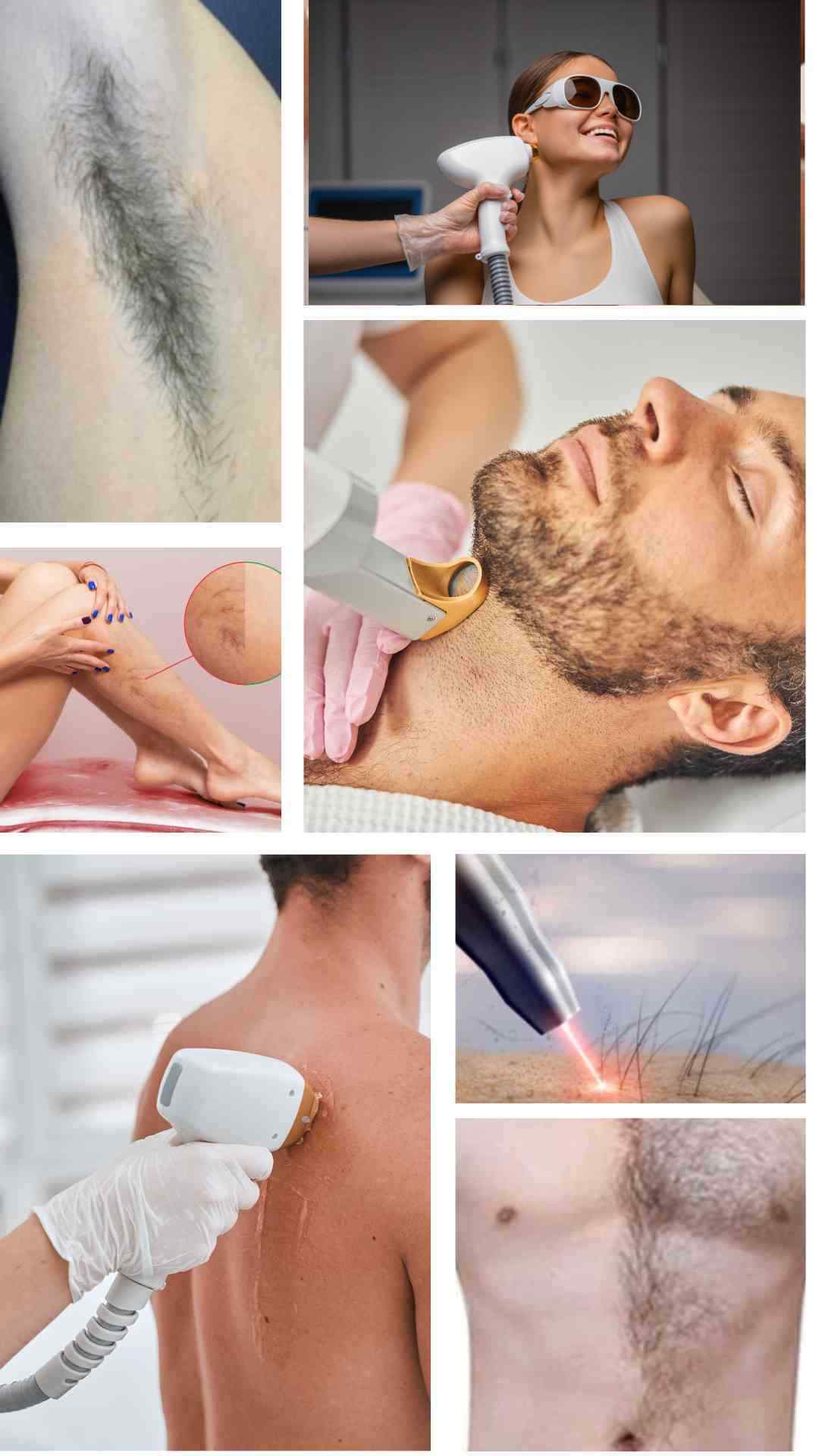 laser hair removal in kuala lumpur