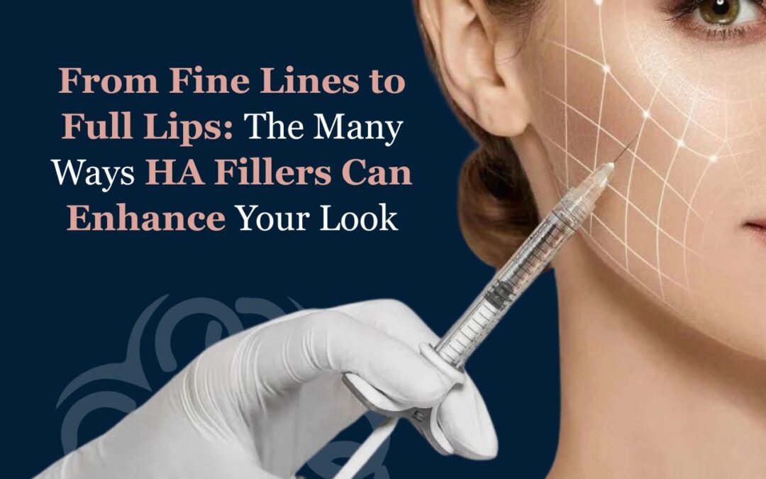 From Fine Lines to Full Lips: The Many Ways HA Fillers Can Enhance Your Look