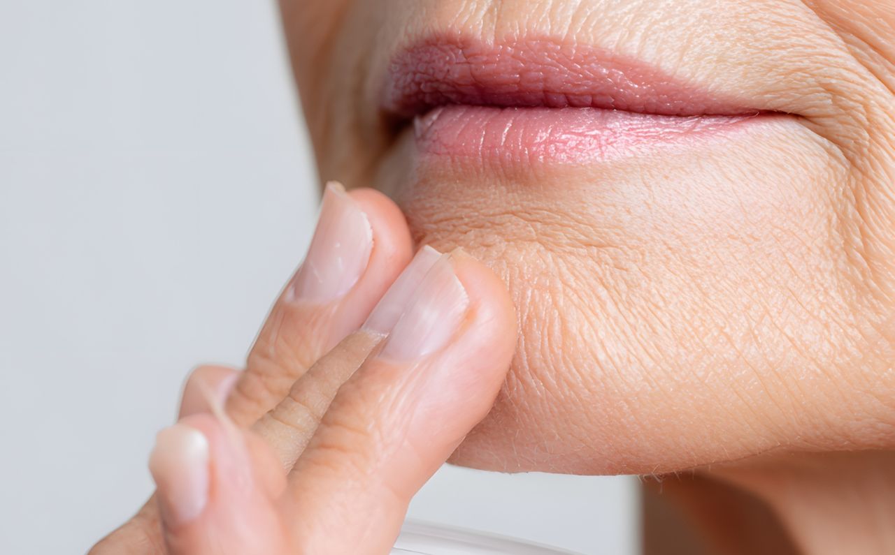 Close-up of a woman’s skin showing signs of thinning and wrinkles, representing individuals who may benefit from Radiesse treatment at Millennium Clinic KL.