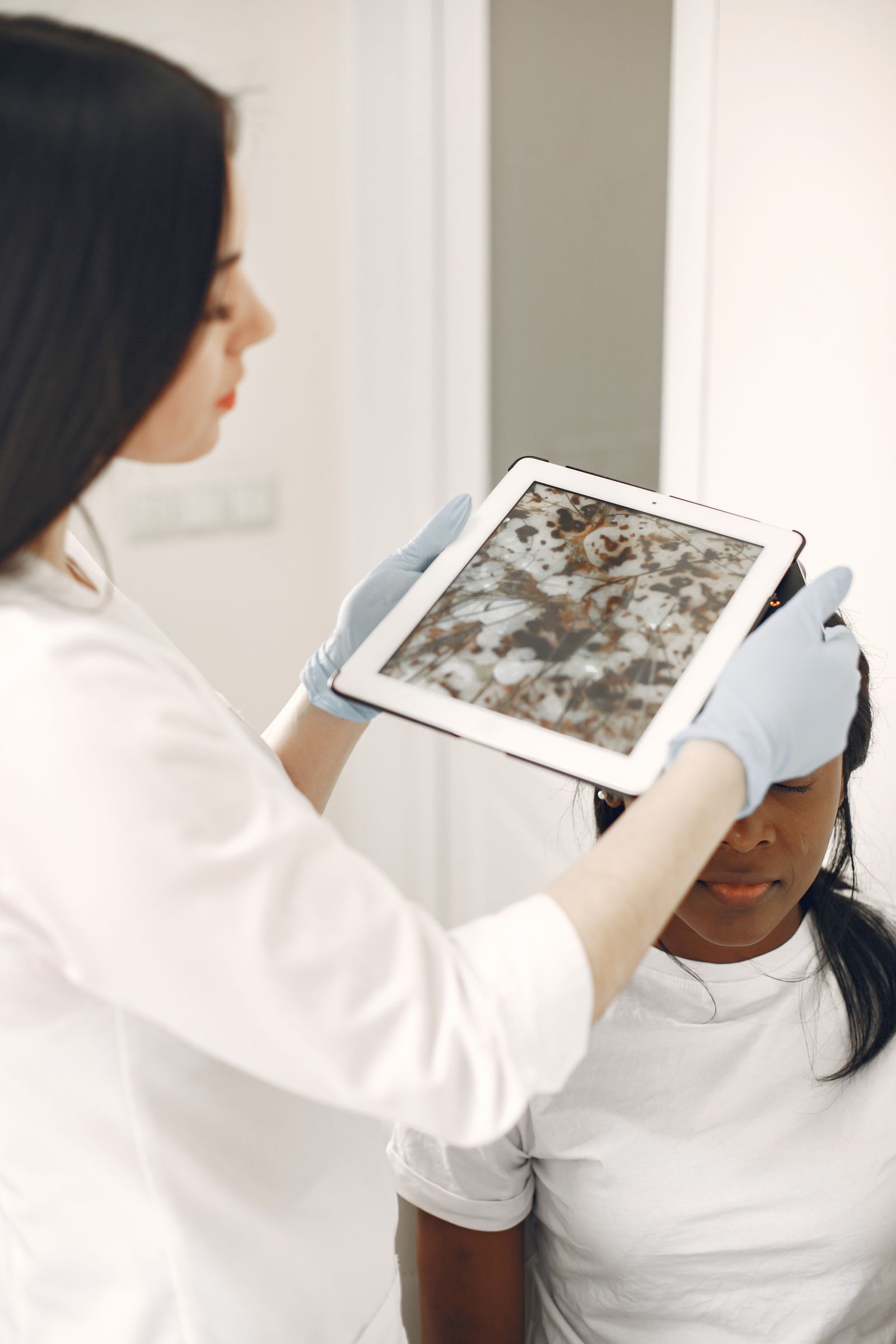 Doctor assessing a patient before acne-scar treatment