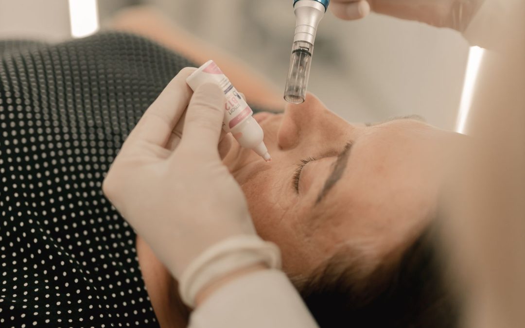 Microneedling-style facial treatment for skin texture concerns