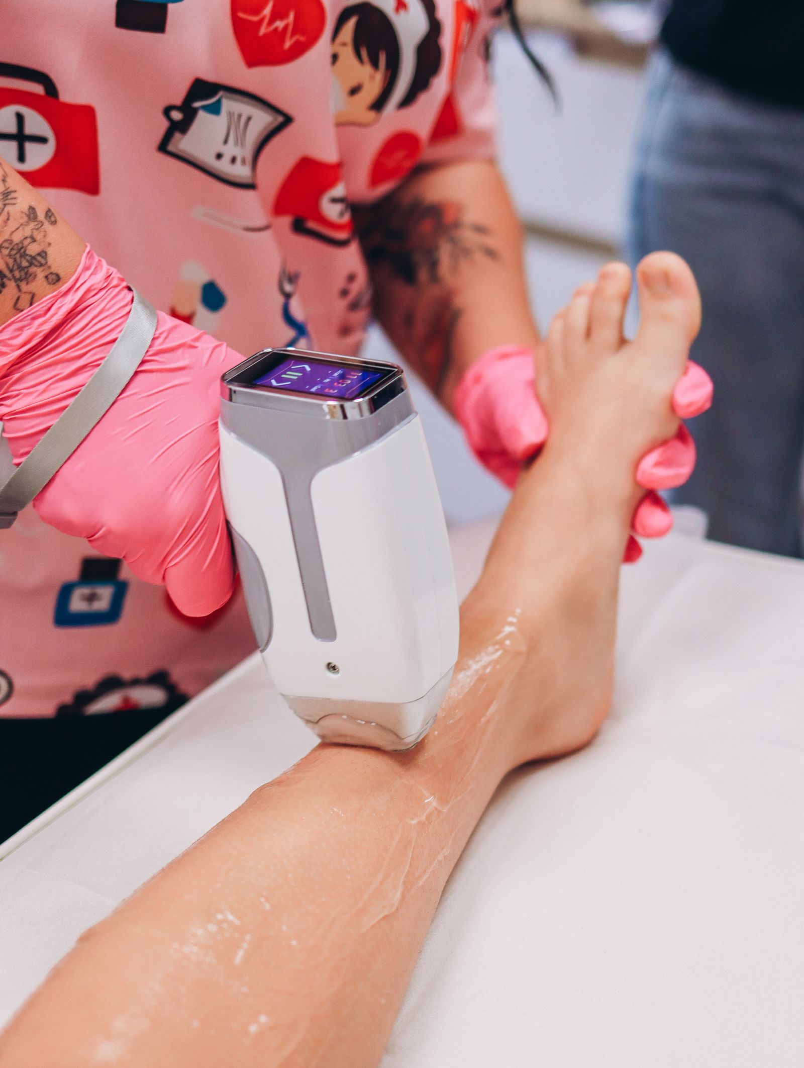 Professional laser hair removal treatment on the lower leg