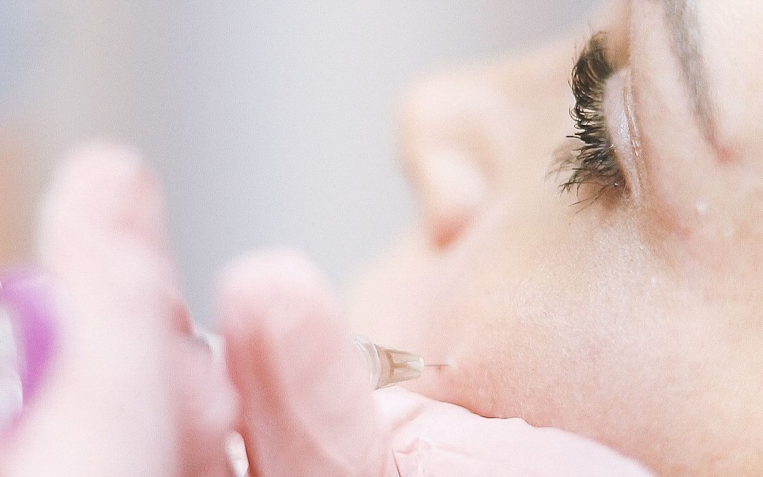 Close-up of a facial injectable treatment performed on the cheek