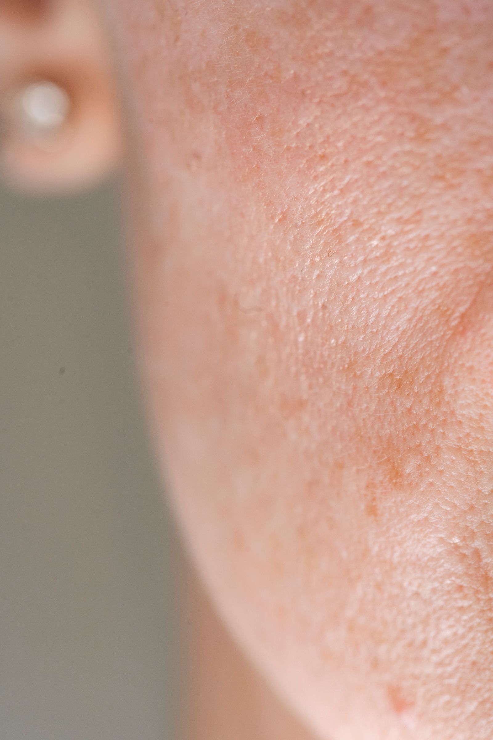 Macro view of natural cheek texture and visible pores