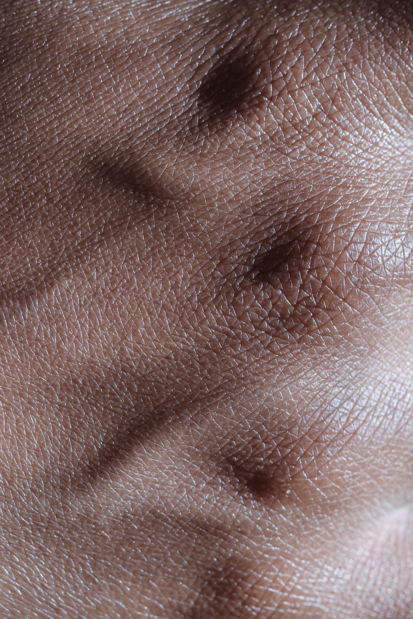 Detailed close-up of natural darker skin texture