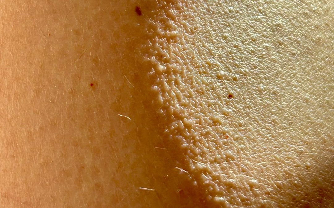 Close-up of natural facial skin texture in soft light