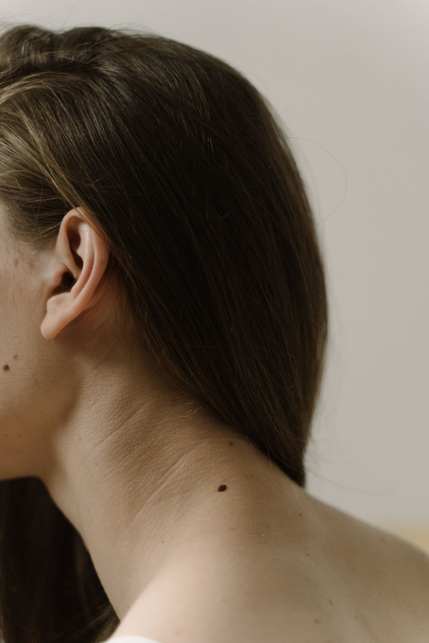 Close-up of neck skin with a small mole illustrating a lesion that needs correct identification