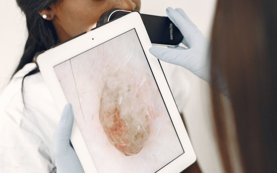 Clinician examining a skin lesion with digital assessment equipment